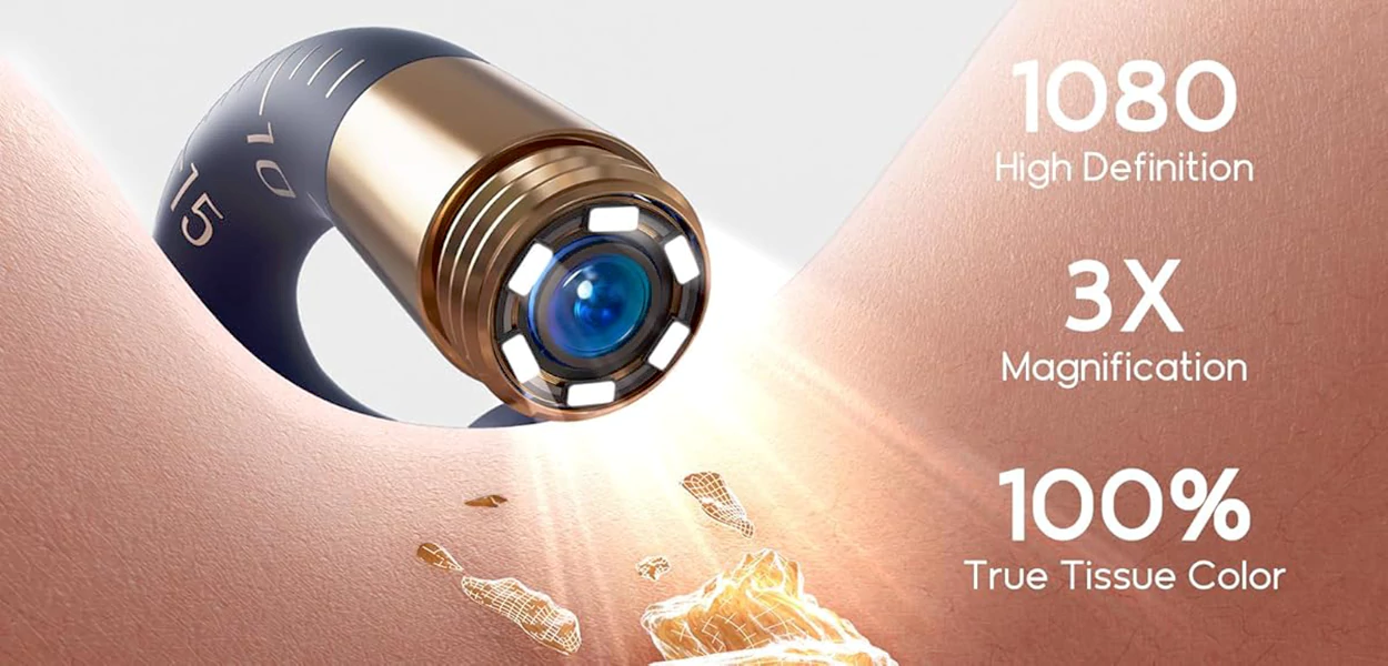 Mi Smart Wax Removal Bebird 135R