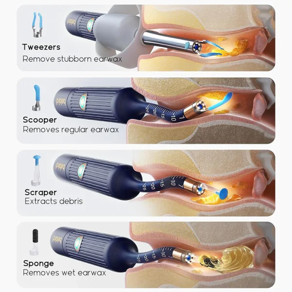 Mi Smart Wax Removal Bebird I35R